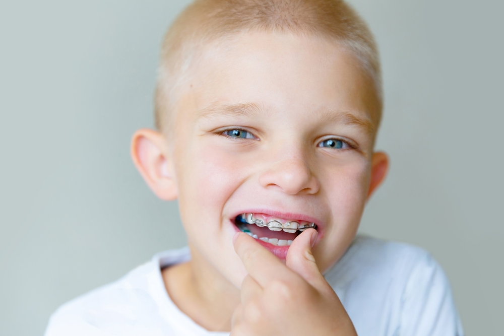Pourquoi intervenir tôt : le rôle de l’orthodontie interceptive chez les enfants
