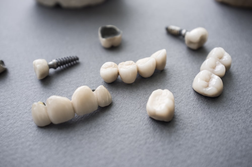 Des restaurations dentaires en céramique qui peuvent être fabriquées avec CEREC