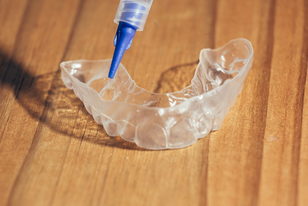 Une gouttière utilisée pour le blanchiment dentaire avec du gel